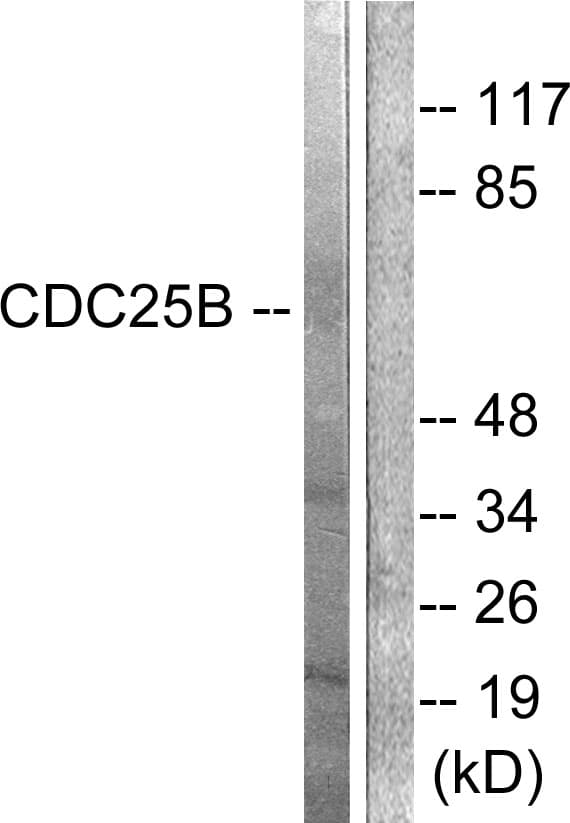 CDC25B Antibody (aa289-338)