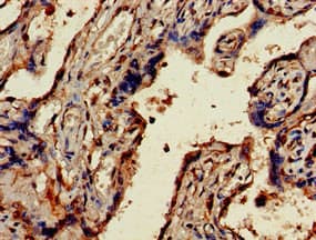 MMS2 / UBE2V2 Antibody