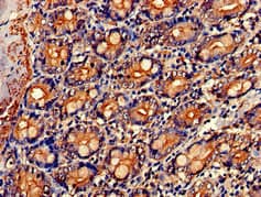 NR0B1 / DAX1 Antibody