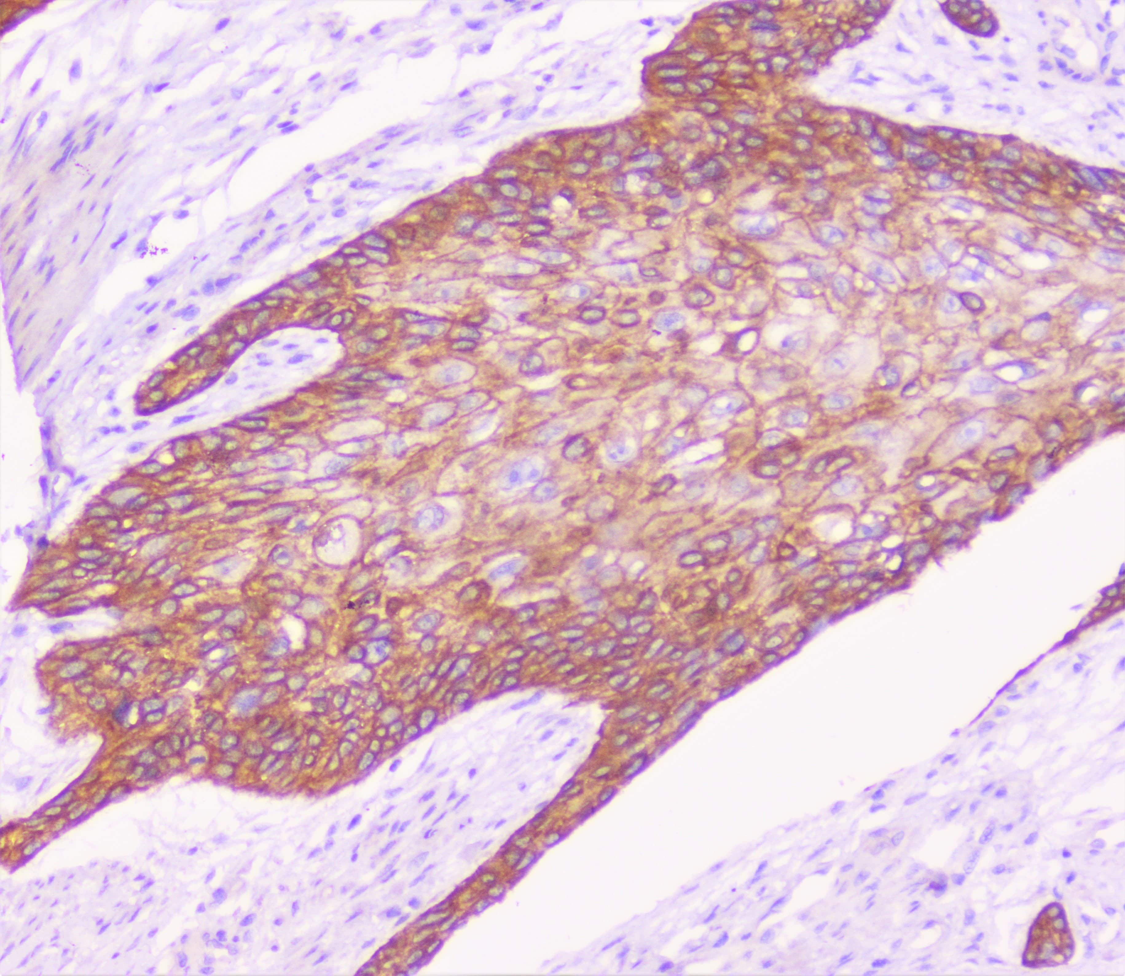 CDH3 / P-Cadherin Antibody