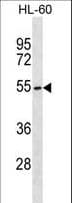 GNT-III / MGAT3 Antibody (aa426-454)