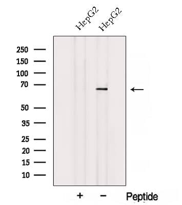 ACSM3 / SAH Antibody