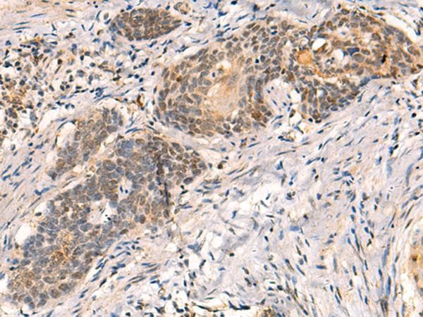 Polyclonal Rabbit anti-Human HNF1A / HNF1 Antibody (IHC)