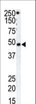 Polyclonal Rabbit anti-Human Rhodopsin Kinase / GRK1 Antibody (aa520-550, IHC, WB)