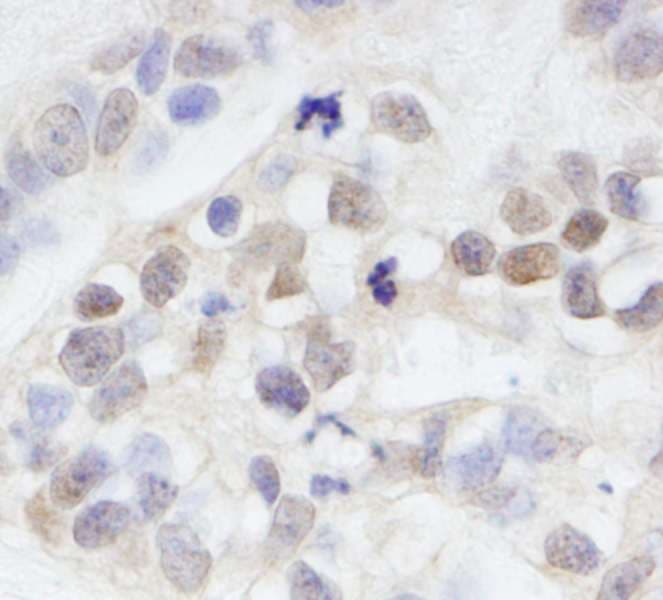 MAGED2 Antibody (aa50-100)