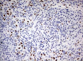 ZEB1 / AREB6 Antibody (aa1-350, clone OTI3G6)