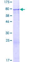 Human TSPYL6 Protein (Recombinant GST)