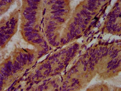 ADGRG1 / GPR56 Antibody