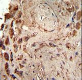 PRKRA / PACT Antibody (Ser246)
