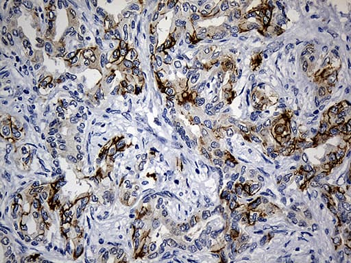 CEP72 Antibody (clone OTI4D2)