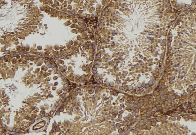Polyclonal Rabbit anti-Human P40PHOX / NCF4 Antibody (IHC, IF, WB)
