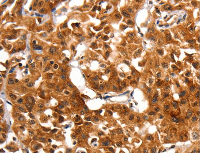 Polyclonal Rabbit anti-Human ADAP1 / CENTA1 Antibody (IHC, WB)