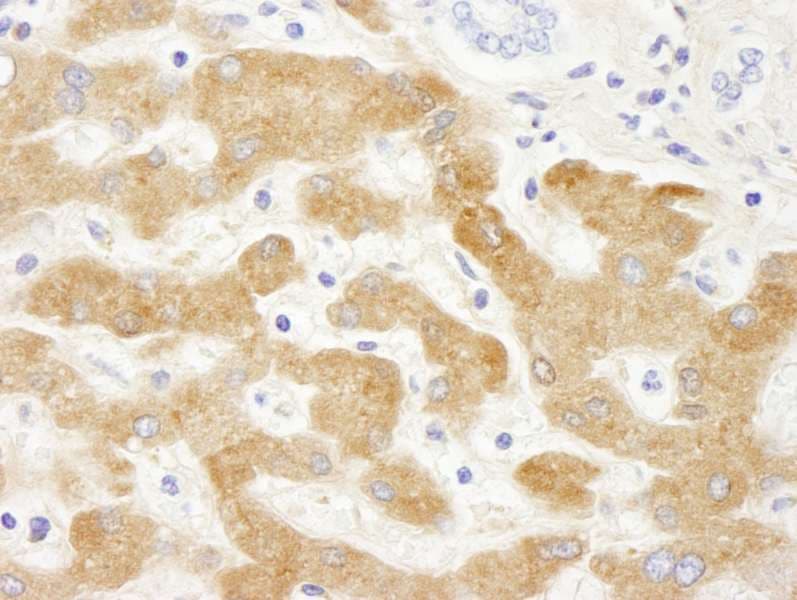 CRP / C-Reactive Protein Antibody