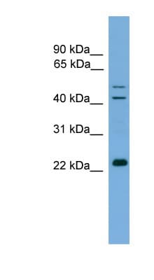 Polyclonal Rabbit anti-Human SLC9A1BP / CHP Antibody (aa35-84, IHC, WB)