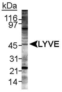 LYVE1 Antibody (C-Terminus, DY488)