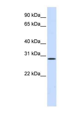 PathPlus™ HGF / Hepatocyte Growth Factor Antibody (aa216-265)