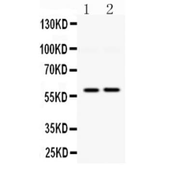 DGAT1 Antibody (aa280-318)