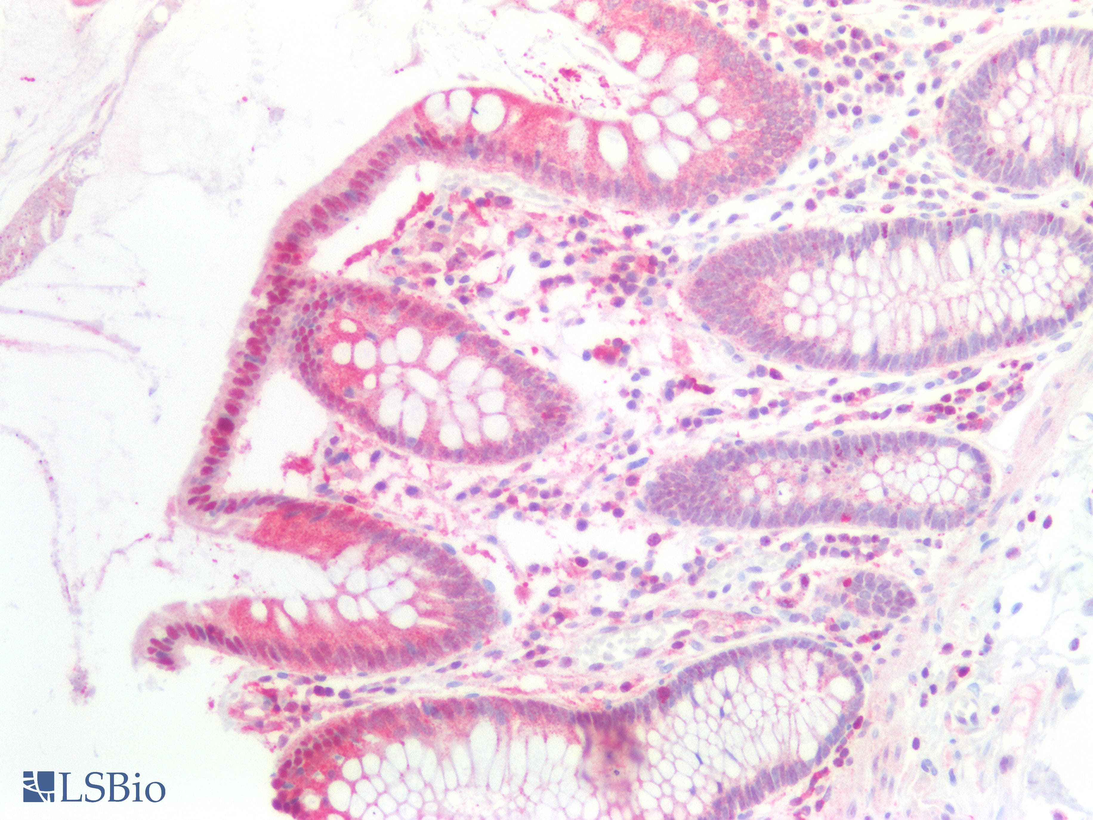 PathPlus™ IL6ST / CD130 / gp130 Antibody