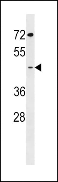 GCNT7 Antibody (aa324-351)