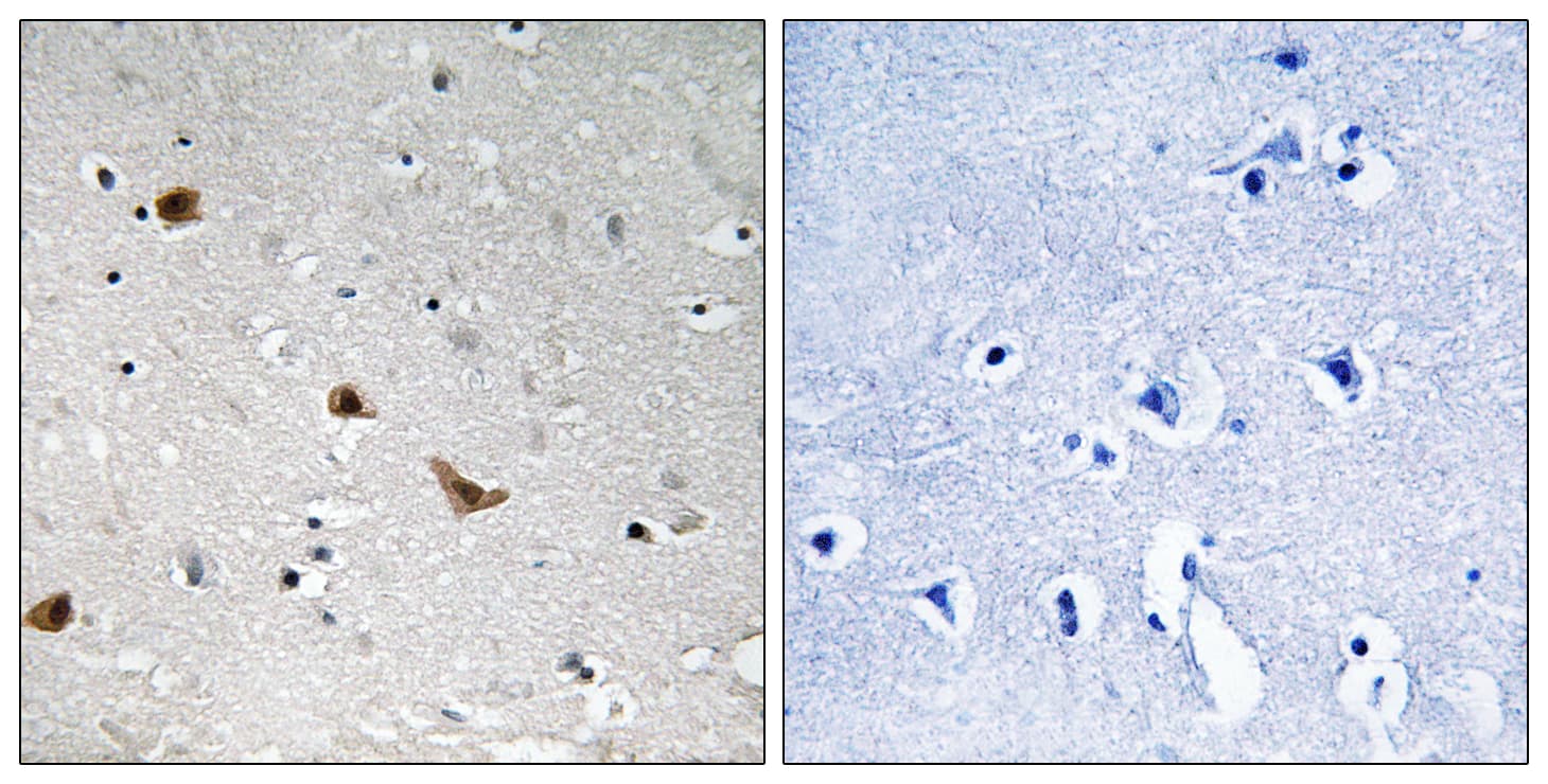 IKBKG / NEMO / IKK Gamma Antibody (phospho-Ser376)