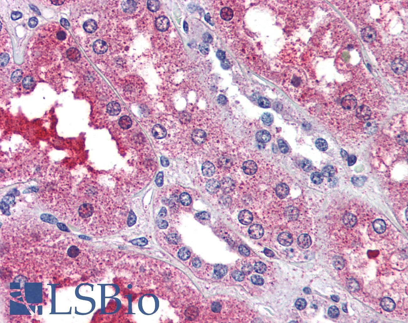 IHC-plus™ Polyclonal Rabbit anti-Human SIPR3 / EDG3 / S1P3 Antibody (N-Terminus, IHC)