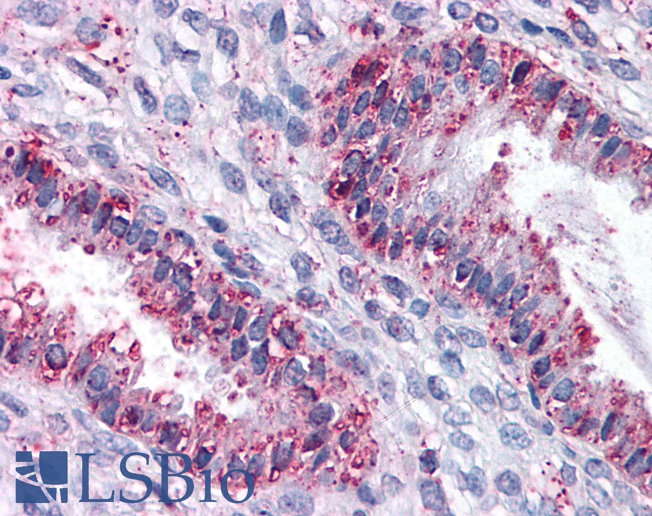 IHC-plus™ Renal Dipeptidase / DPEP1 Antibody (N-Terminus)