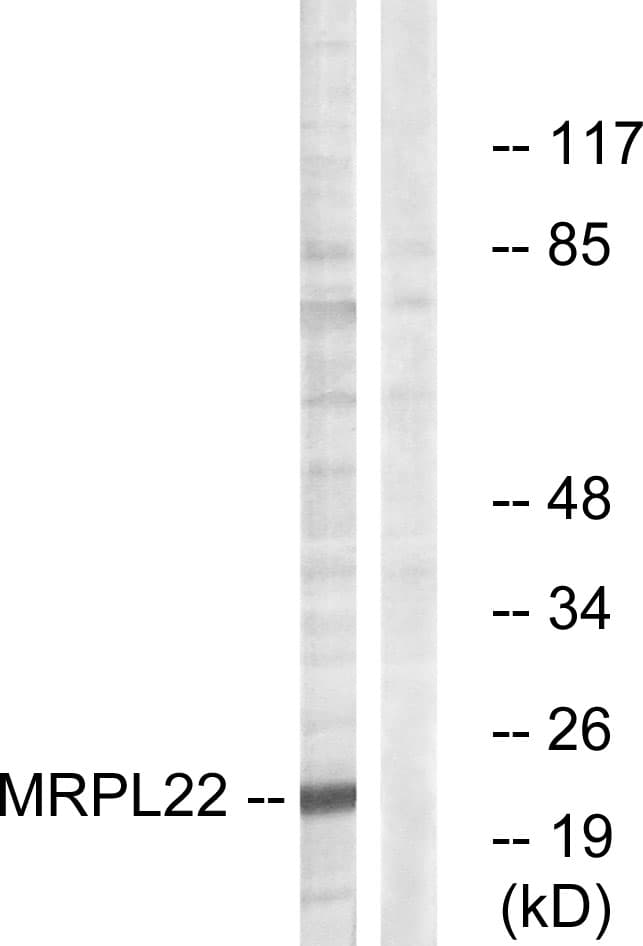 MRPL22 Antibody (aa91-140)