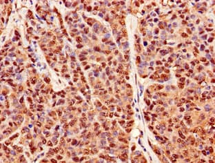 PRDX6 / Peroxiredoxin 6 Antibody