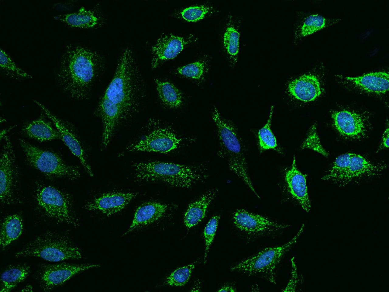 Polyclonal Rabbit anti-Human ADAM15 Antibody (IHC, IF)