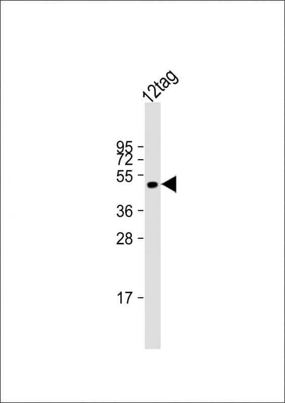 DYKDDDDK Tag Antibody (clone 1557CT661.18.1)