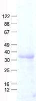 Human TOMM40L Protein (Recombinant His, N-Terminal)