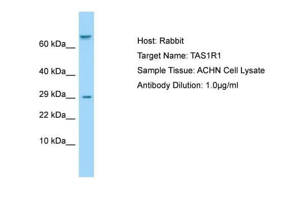 Polyclonal Rabbit anti-Human T1R1 / TAS1R1 Antibody (aa327-376, WB)