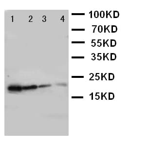 GH / Growth Hormone Antibody (aa27-216)