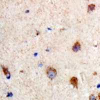 Polyclonal Rabbit anti-Human PRKCQ / PKC-Theta Antibody (C-Terminus, IHC, WB)