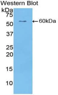 CILP Antibody (aa603-846)
