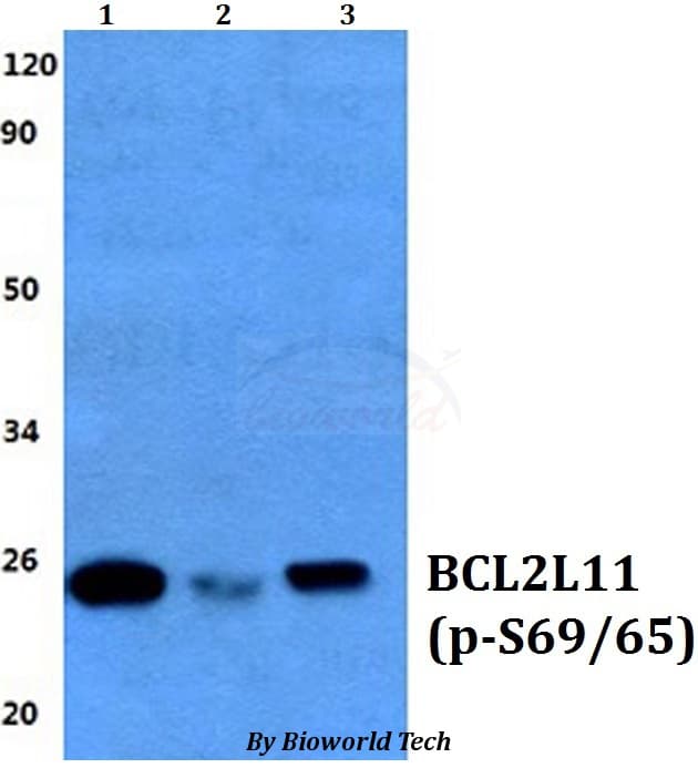 Polyclonal Rabbit anti-Human BCL2L11 / BIM Antibody (phospho-Ser69/65, WB)
