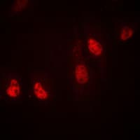 RPL36 / Ribosomal Protein L36 Antibody (Internal)
