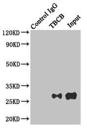 Polyclonal Rabbit anti-Human TBCB / CKAP1 Antibody (IHC, WB)