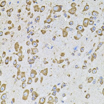 CYBB / NOX2 / gp91phox Antibody
