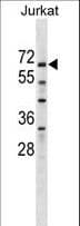 ZNF498 Antibody (aa165-193)
