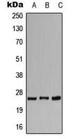 CACNG1 / CACNG Antibody (Internal)