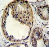 Polyclonal Rabbit anti-Human AKT1 Antibody (Thr308, IHC, WB)