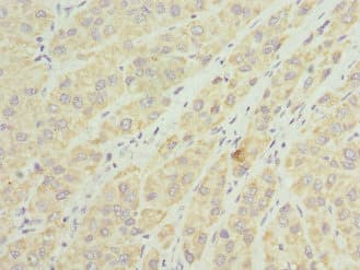 TIMM8A Antibody