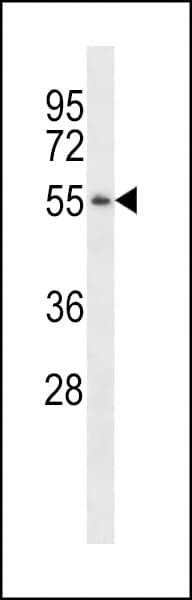 PGA5 / Pepsin A Antibody (aa45-73)