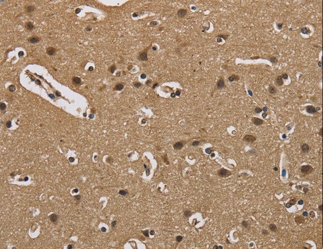 I-FABP / FABP2 Antibody