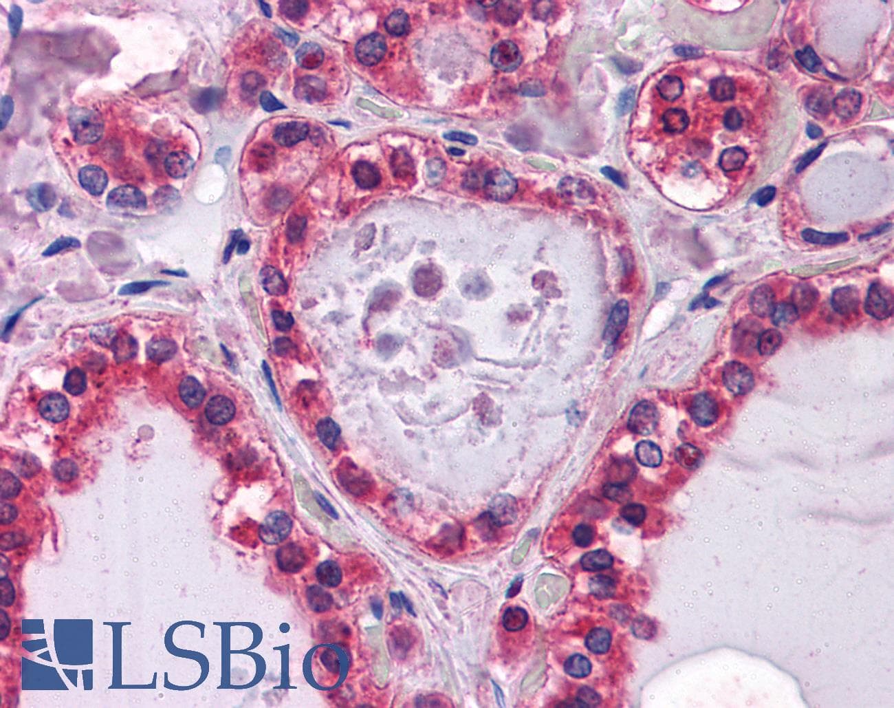 IHC-plus™ LAMB1 / Laminin Beta 1 Antibody (clone 2D9G5)