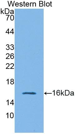 GLP1R / GLP-1 Receptor Antibody (aa25-145)
