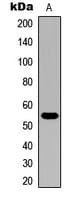 CYP21A2 Antibody (Internal)