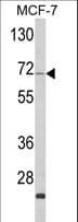 ZYG11A Antibody (aa71-97)