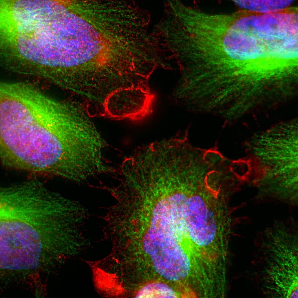 Polyclonal Chicken anti-Human MARCKS Antibody (IHC, IF, WB)